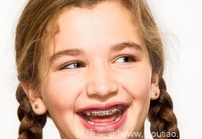 儿童牙齿矫正，几岁开始比较好?