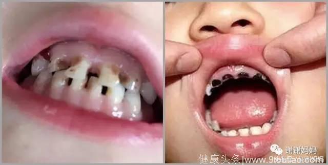 儿童口腔专家是建议这样刷牙的！