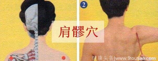 治疗肩周炎