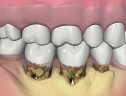 儿童牙齿松动是怎么回事，缺少什么微量元素吗