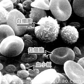 关于慢性粒细胞白血病，你了解多少？