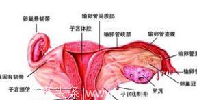 多发性子宫肌瘤的种类都有哪些