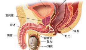 前列腺里也会长石头 带您了解前列腺结石的症状