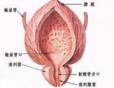 总结前列腺结石的常见病因