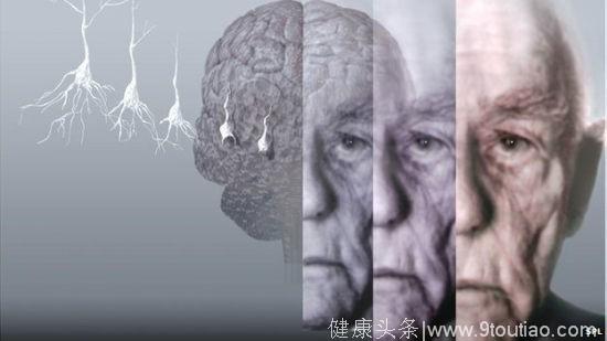 如何减缓记忆衰退，减少或避免“老年痴呆”现象的发生