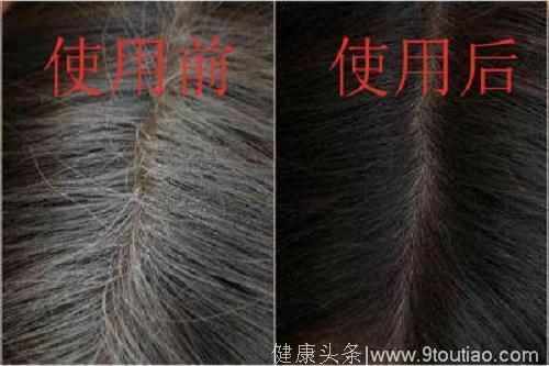 女人头上长出了白发？这3种土方法坚持一月，头发柔顺慢慢变黑