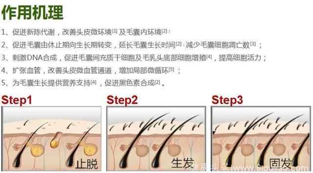 女性型秃发诊治流程图