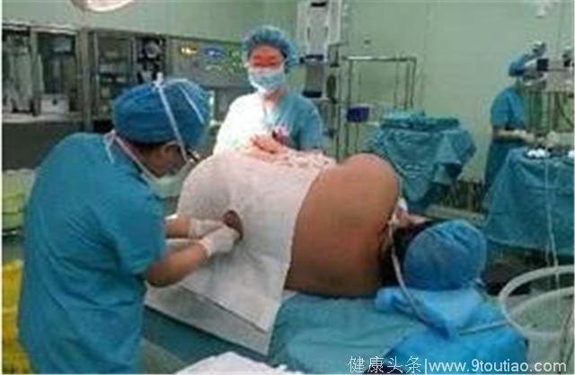 260斤孕妇生孩子告诉你为什么医生不建议肥胖的人生孩子
