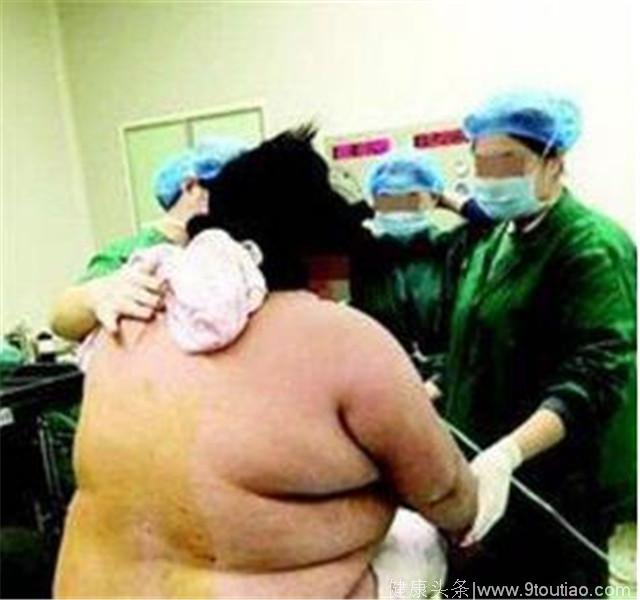 260斤孕妇生孩子告诉你为什么医生不建议肥胖的人生孩子