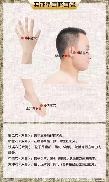 中医针灸治疗耳鸣耳聋