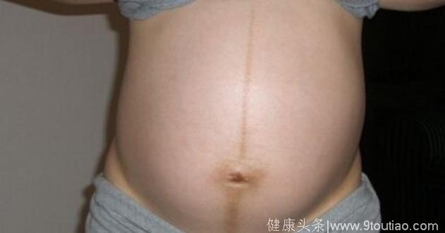 怀孕后妈妈的肚子上竟然有一条黑线，这是什么原因呢