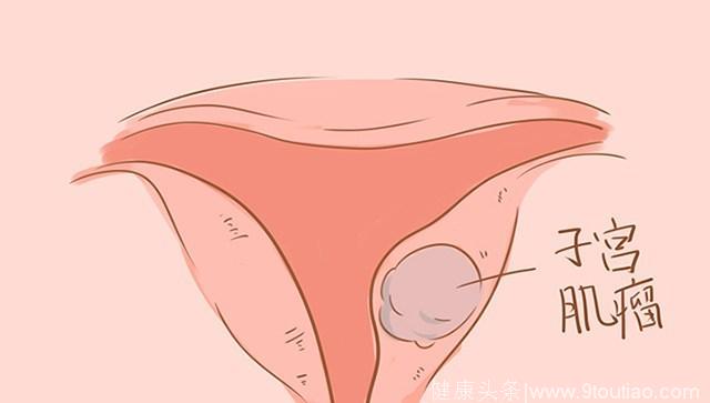 孕4月出现这2种腹痛一定要重视，不然可能会抑制胎儿发育