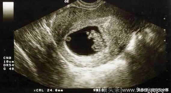 怀孕6个月却发现胎儿不在子宫里，原因让人难以置信
