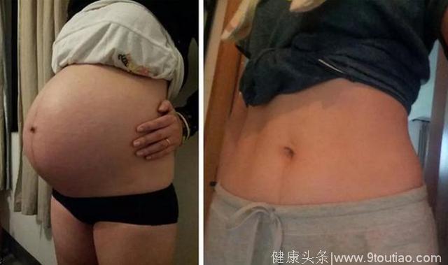 生出胎儿后，孕妇体重会一下减轻多少