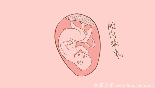 胎儿缺氧要及时引起重视，长期处于缺氧状态将影响宝宝脑部发育