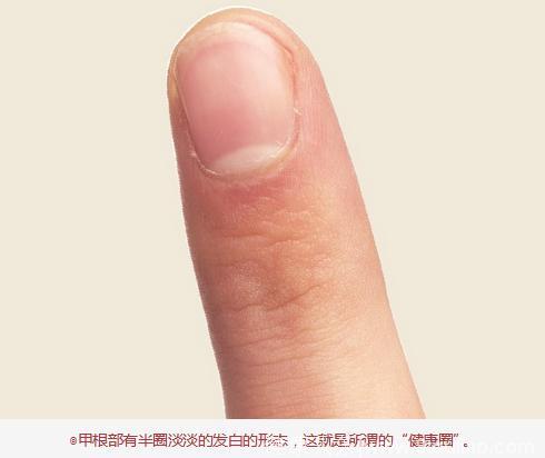 指甲要告诉你的健康信息，你的指甲根有没有“健康圈”？