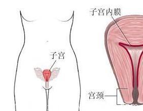 功能性子宫出血主要因素是哪些导致