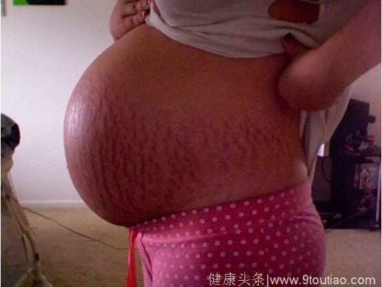 43岁妈妈不听医生劝阻，偷偷怀上二胎，孩子出生后当场哭了！