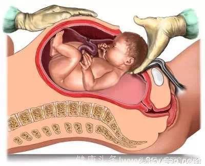 剖腹产对宝宝的3大影响，看完你会选择剖腹产吗？
