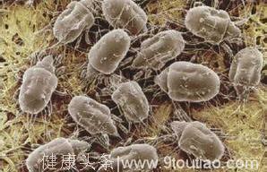 螨虫细微却危害很大，对人造成的伤害可能是永久性的！你还敢继续无视它吗？