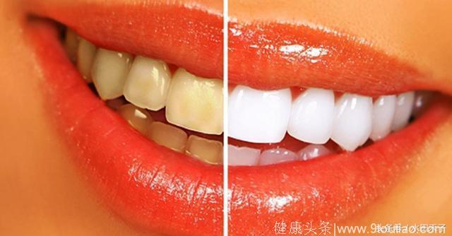 你还在让牙黄牙垢影响你的颜值吗？教你5分钟消灭牙垢，快速让牙齿变亮变白