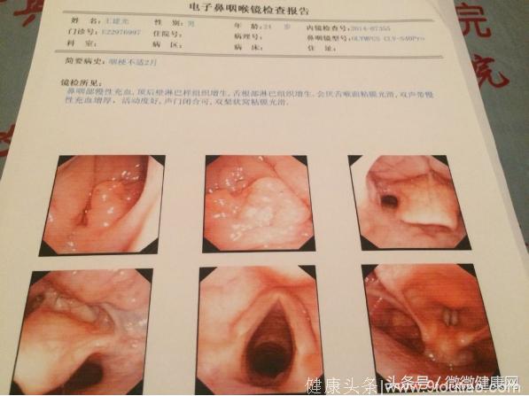 根据古方配药，治疗慢性咽炎，最快5天见效