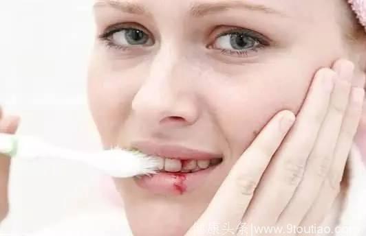 史淑荣提醒：出现牙龈肿、粘膜出血，小心，可能是白血病！