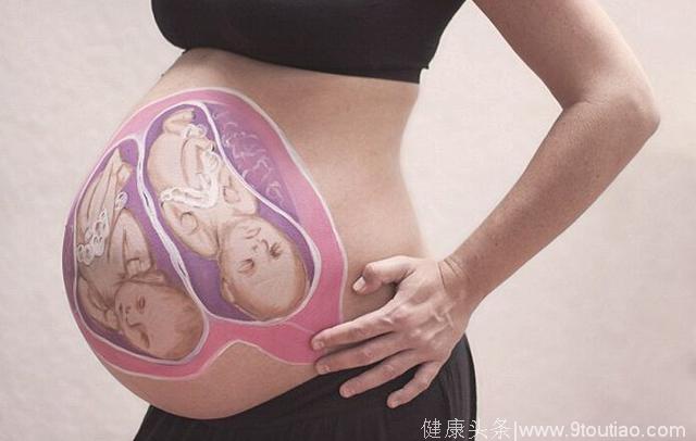 剖腹产收获小男子一枚，孕期肚子中间一条黑色的直线
