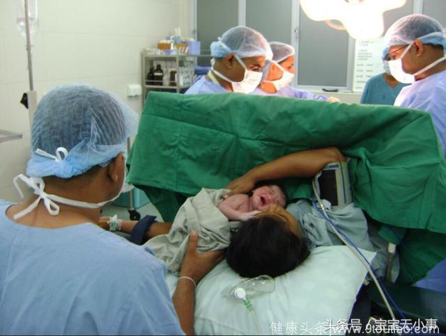 产妇为了省钱不做产检，生下孩子后医生都被吓到了
