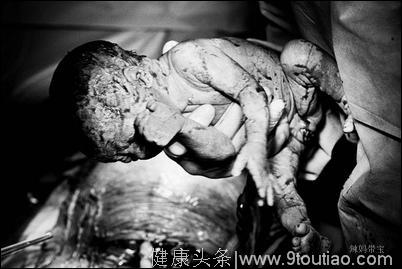 国外摄影师手术室直击一个婴儿从母体取出来的过程，怕引起读者不适，图片后期都处理成黑白的了