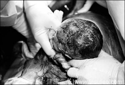 国外摄影师手术室直击一个婴儿从母体取出来的过程，怕引起读者不适，图片后期都处理成黑白的了