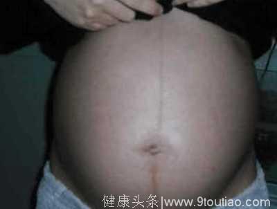 怀孕后身体3个部位越变越黑？别尴尬！这是宝宝健康的信号！