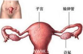 子宫囊肿是如何影响女性怀孕的