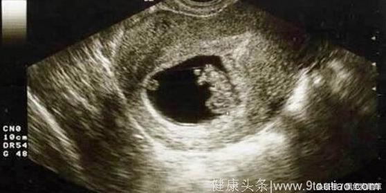 准妈妈切记：检测到自己怀孕了，最好及时去医生再检查一次，胎儿发育不好后果很严重