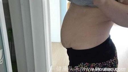产后一个月，肚子为何依旧大如怀孕？医生却笑笑解释不碍事！