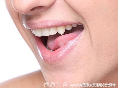 22岁一天三包槟榔，张开嘴巴的一瞬间，医生说可能是舌癌！