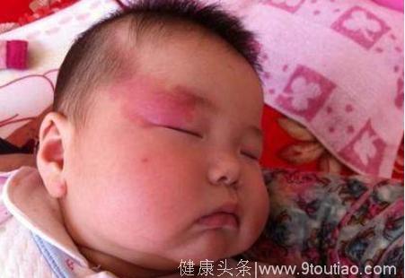 刚出生宝宝满身胎记，医院检查后，宝妈痛打自己耳光！