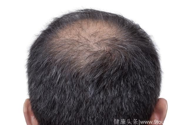 5种高发“男人病”，你碰上几个了？