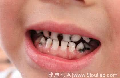 8个有关孩子的牙齿问题，都是干货！