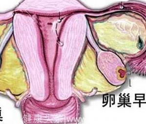 卵巢功能早衰四大原因女性应该积极的预防
