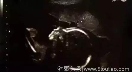 原来B超单应该这样看男女，90%的妈妈都说“太准啦！”