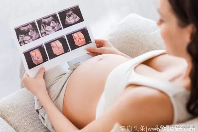 宝宝脐带绕颈几周就要剖腹产？这些孕期知识你一定不了解