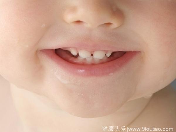 针对宝宝“小牙牙”诞生，希望对年轻的爸妈不要再错过了