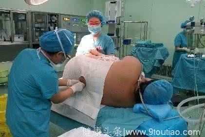260斤孕妈剖腹生娃，医生擦汗说简直在刨坑，差点被胎儿吓晕！