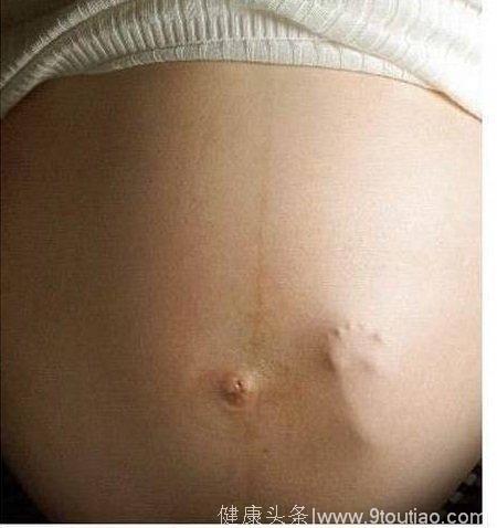 胎宝宝想对妈妈说的话全都表现在了身体上，这8个症状孕妈你有吗