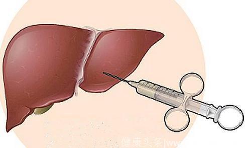 肝脏拥有的6个功能，一旦损伤，肝病肝癌旋即而来！