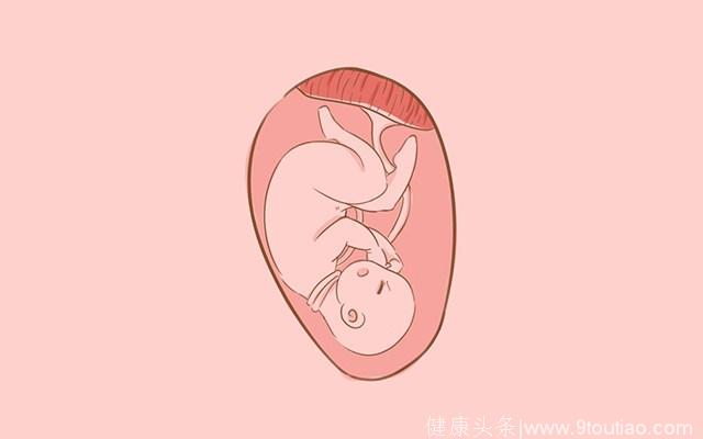 脐带绕颈有危险，孕妈做好这几点才能真正保护好胎宝宝，别忽视