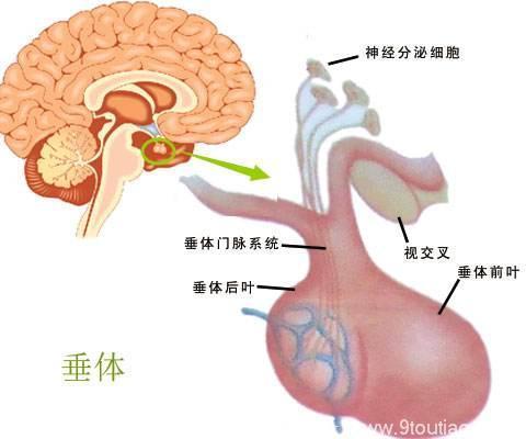 竟致性功能减退？垂体瘤到底是什么病？出现这些症状需警惕！