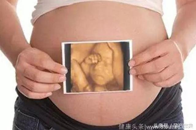 双胞胎或超重孕妇，应该如何选择四维彩超？