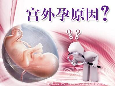 因为宫外孕切掉了一侧输卵管的人，还能正常怀孕吗？